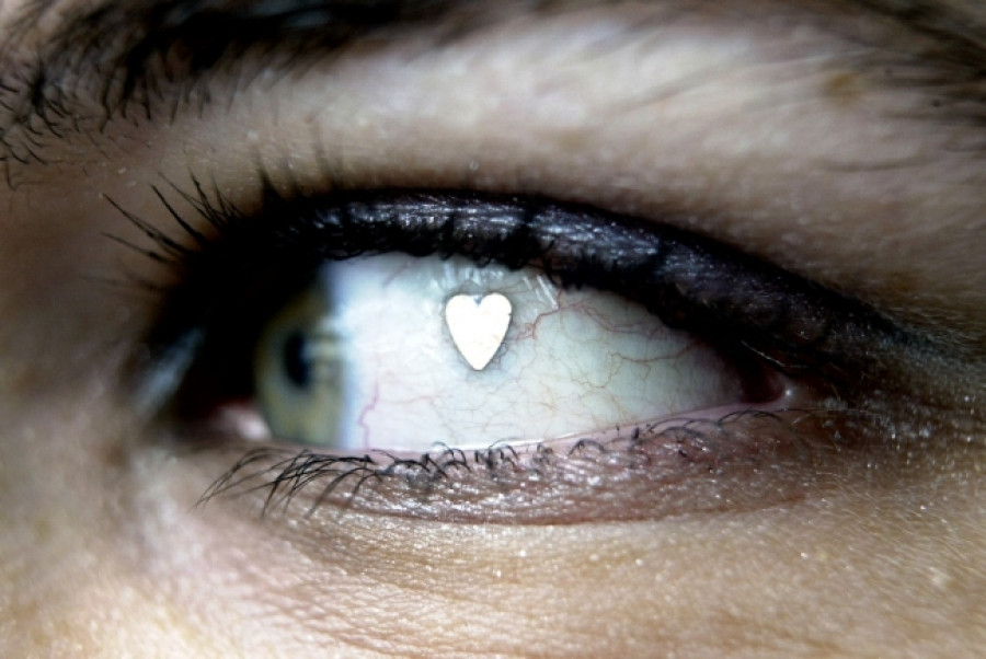 Say bye to dark eye circles with DIY tips