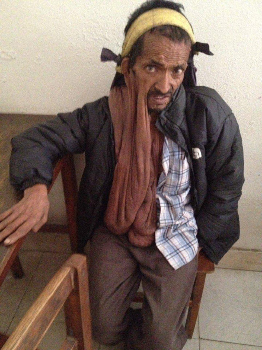 Man seeks help for tumor treatment