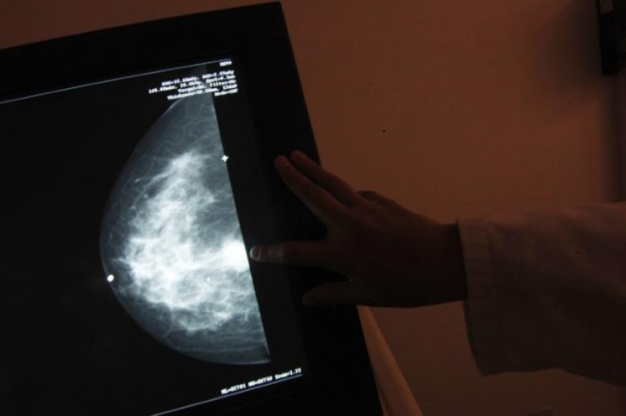 Lots of sleep tied to worse breast cancer survival odds