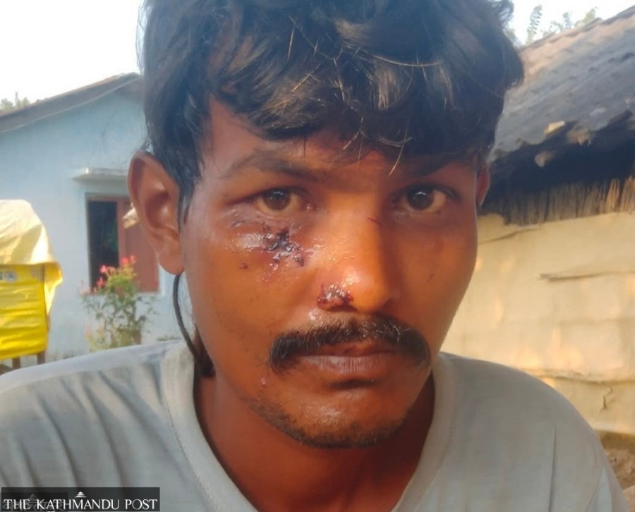 Monkey attack injures 14 people and one cow dead