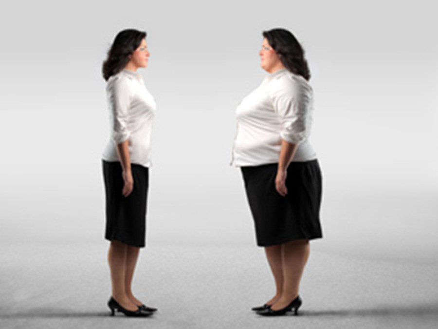 Weight-loss surgery offers hope to morbidly obese