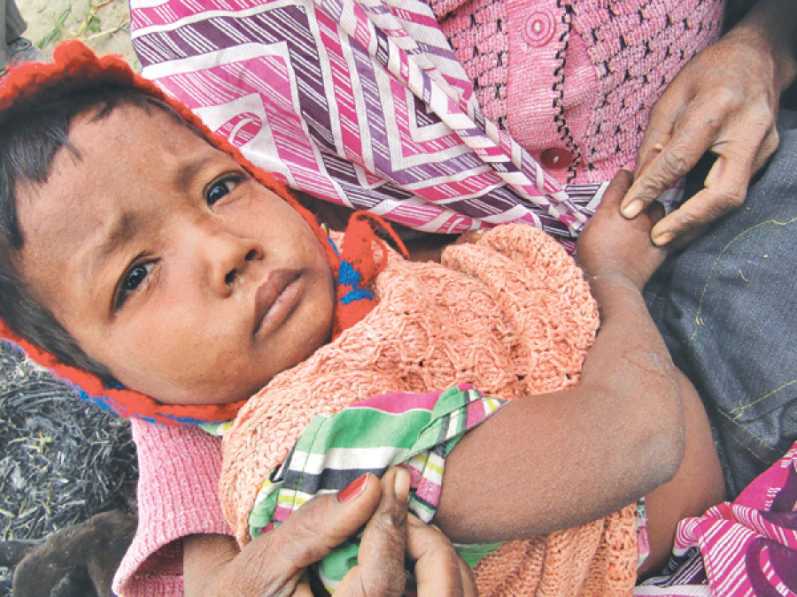 Measles ‘under control’ in Kapilvastu villages