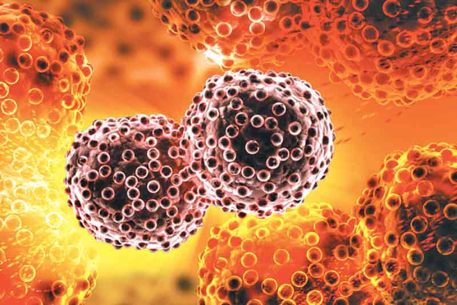 Most patients seek care when disease is at advanced stage