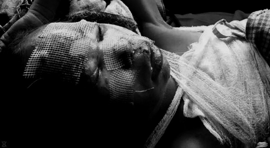 Woman horrifically attacked by hubby