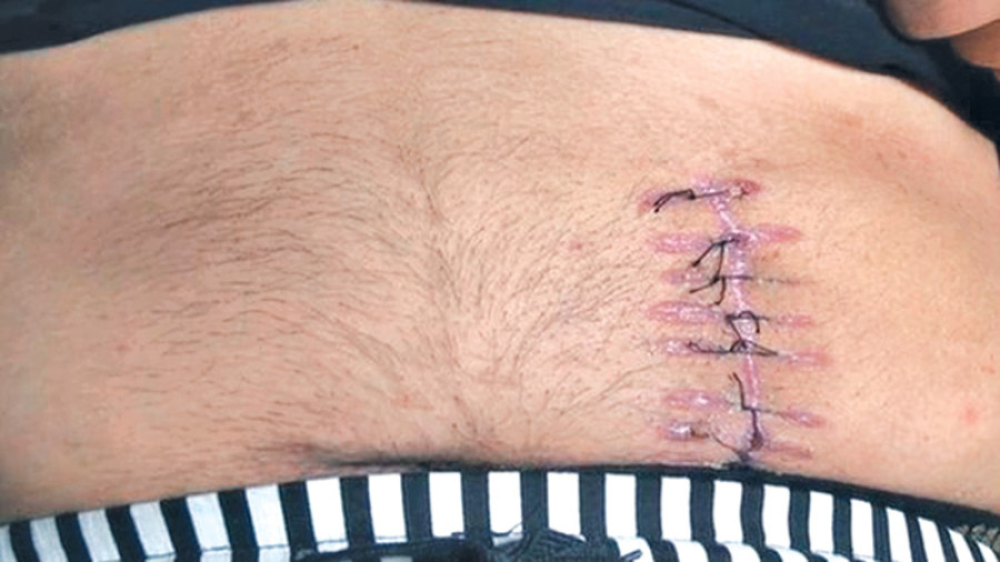 Organ traffickers ‘run health camps’ to lure people