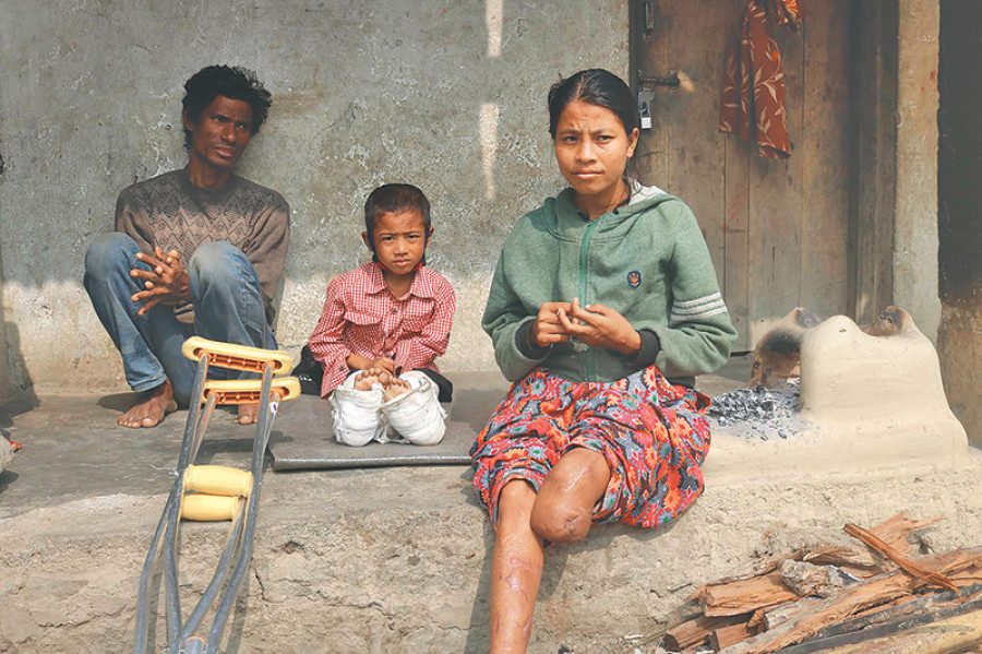 CPN-UML dumped me: Blast victim