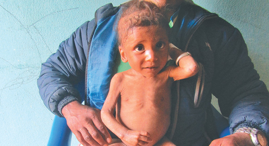 146 children suffering from malnutrition in Rukum: DHO