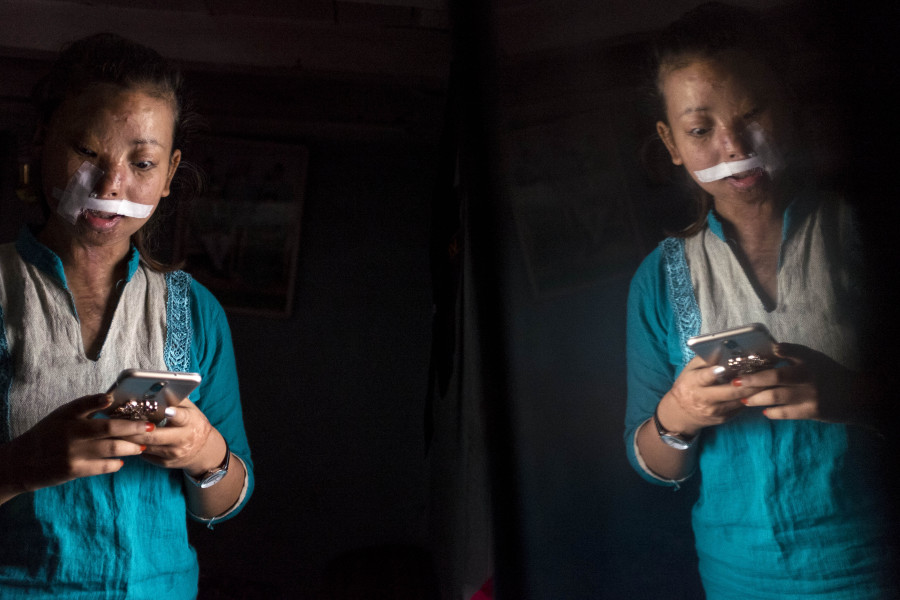 Meet the acid attack survivor who challenged Nepal's laws to help others like her