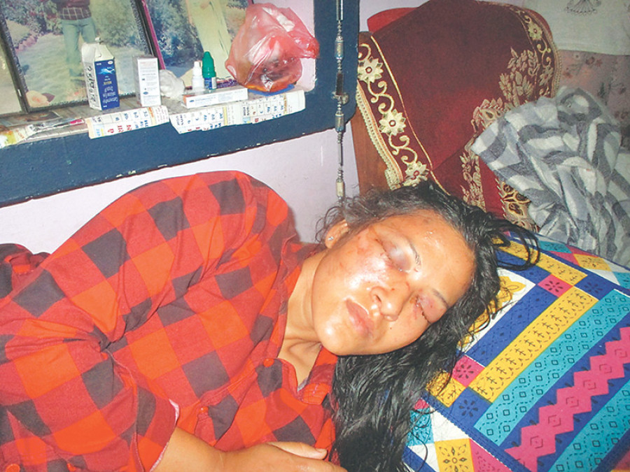 Woman, 23, severely beaten for refusing marriage proposal