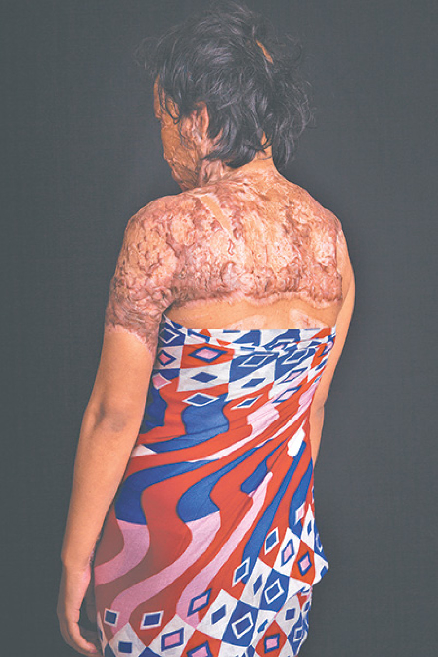 More women report domestic violence