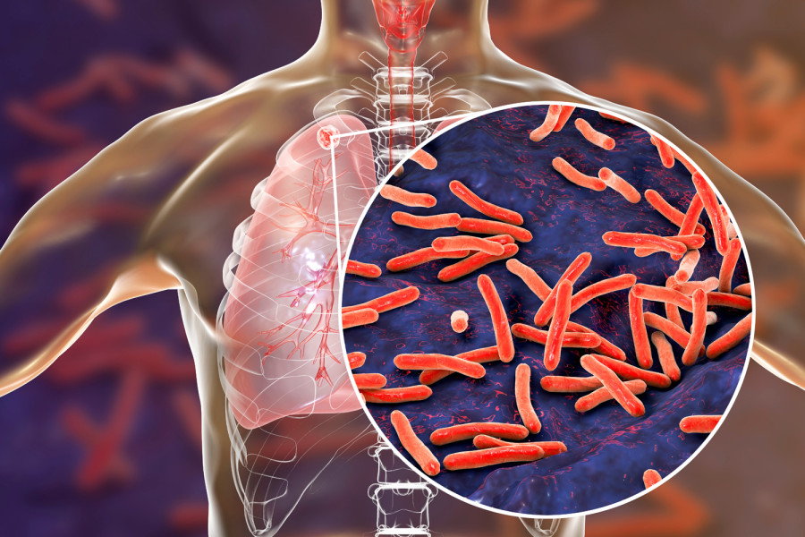 National TB Center forced to purchase TB vaccine from Indian black market