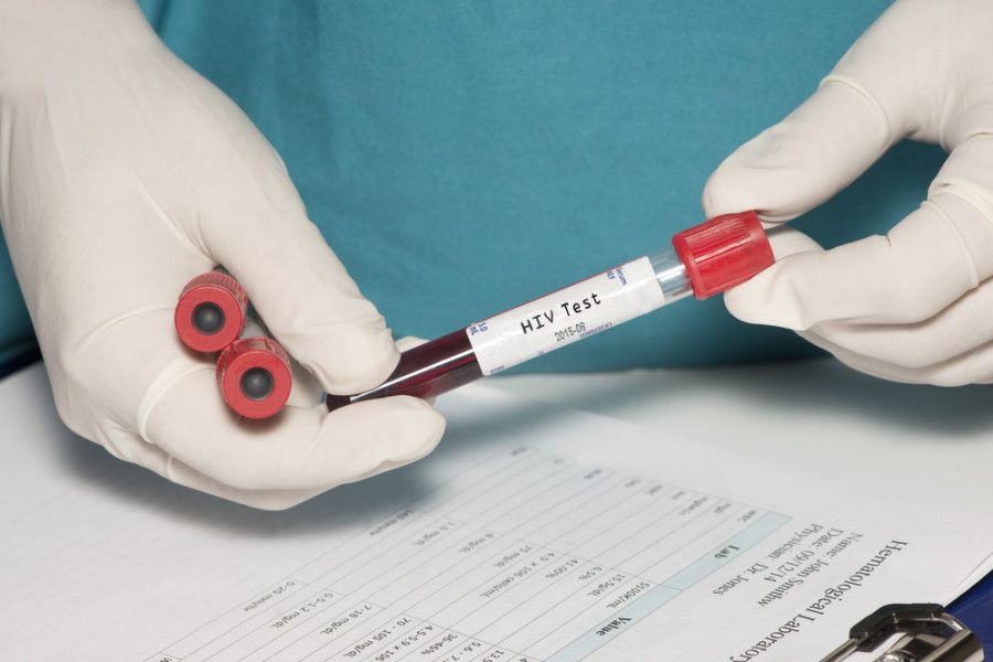 Greater urgency required to detect all hidden HIV cases to meet UN 2020 goals
