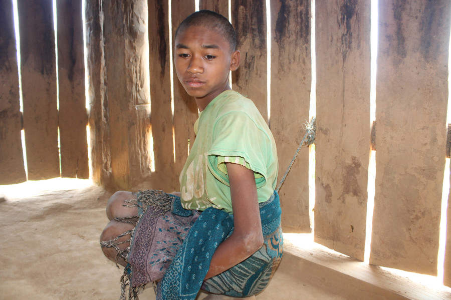 Family confines 14-year-old disabled boy at home