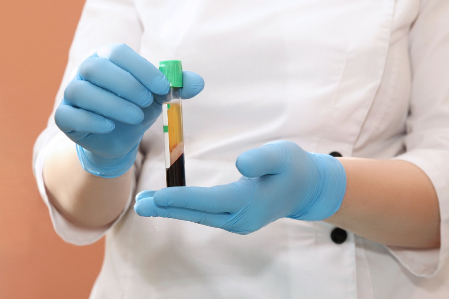 What is convalescent plasma therapy, how it works and does it work for Covid-19