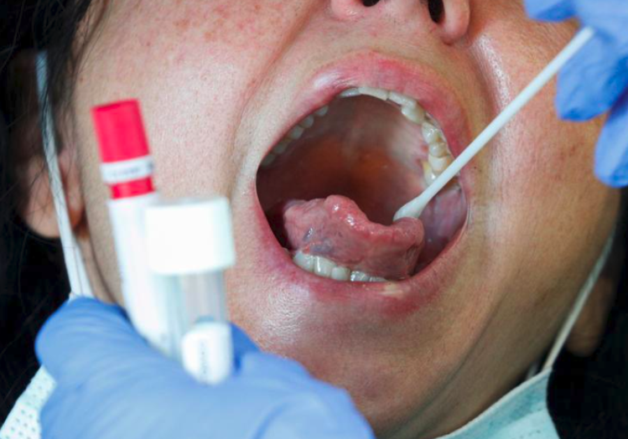 Countries turn to rapid antigen tests to contain second wave of COVID-19