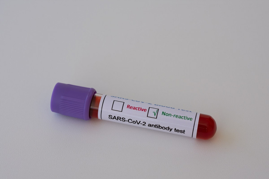 Current efforts to slow the virus not working, time to start antibody tests, doctors say