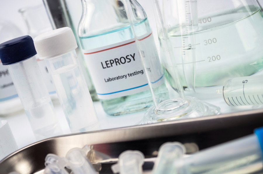 Number of leprosy patients on the rise in Bagmati Province