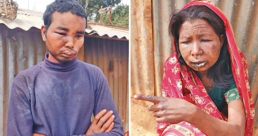 One dead, three injured at the hands of faith healers in Gulmi