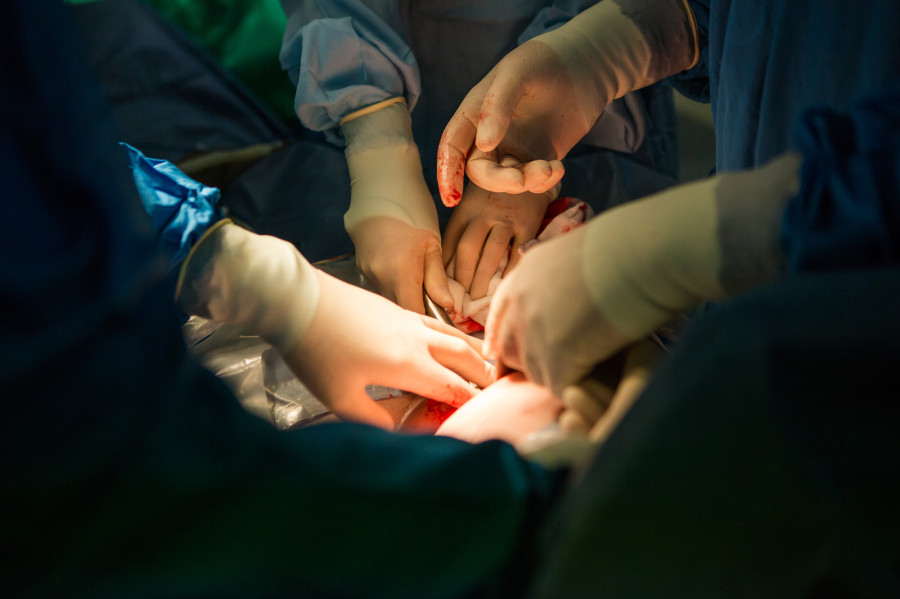 Caesarean section delivery service to be expanded to all 77 districts