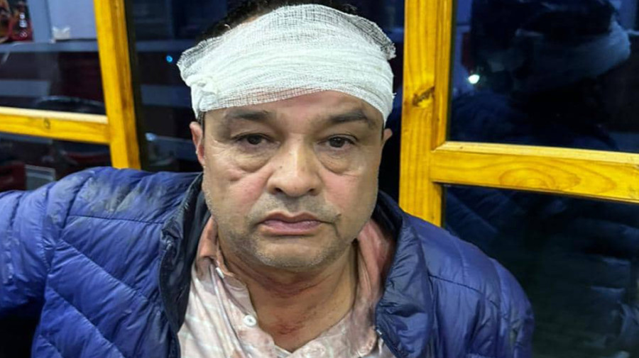 UML’s team electioneering in Gorkha attacked