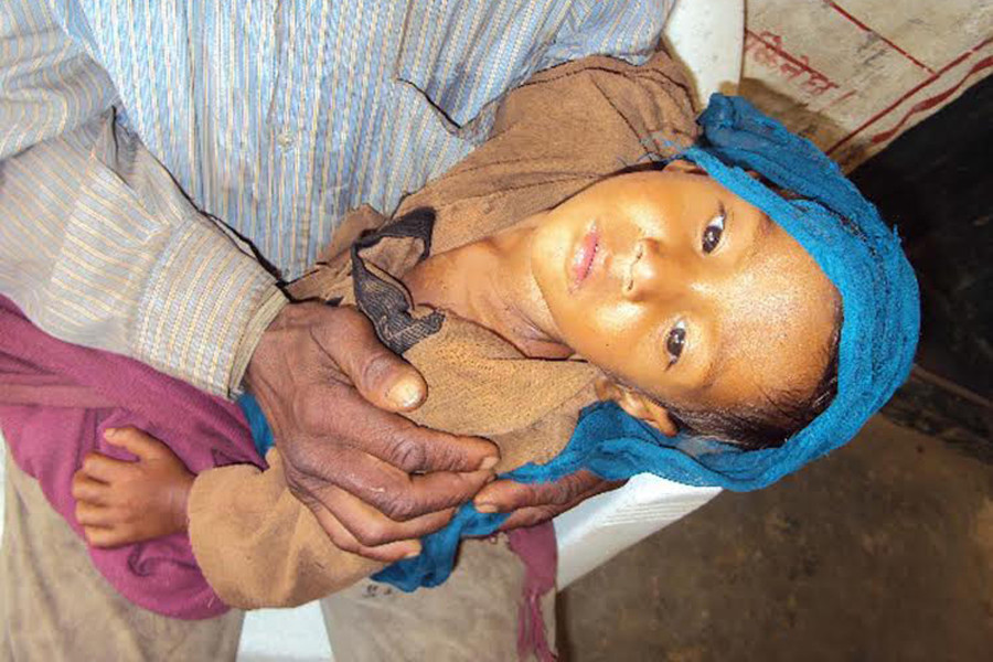 Karnali failing to curb malnutrition in children