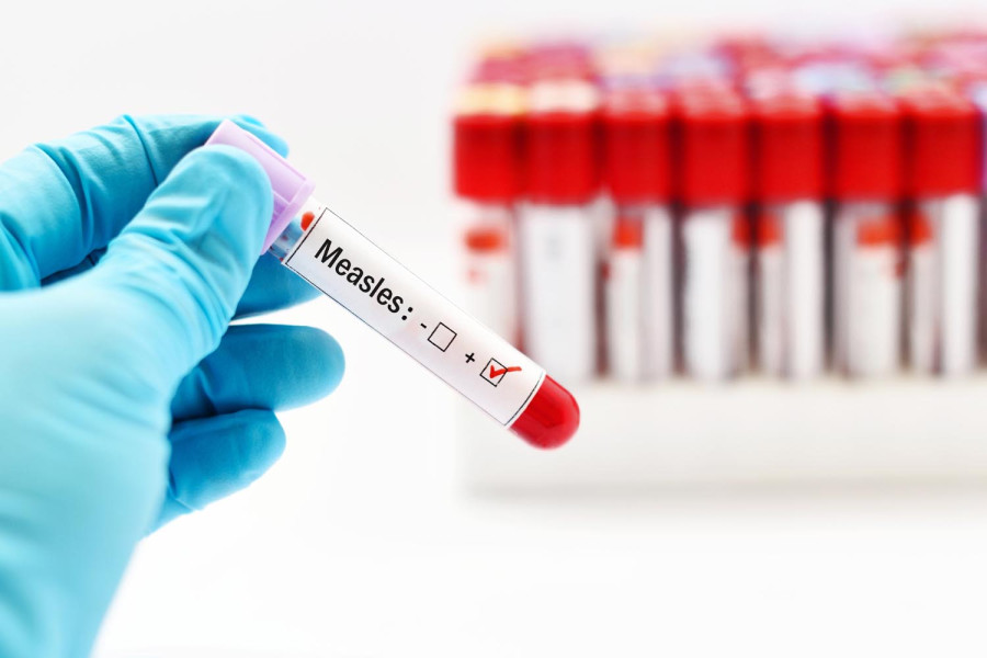 Nepal to request GAVI for measles, human papillomavirus vaccines