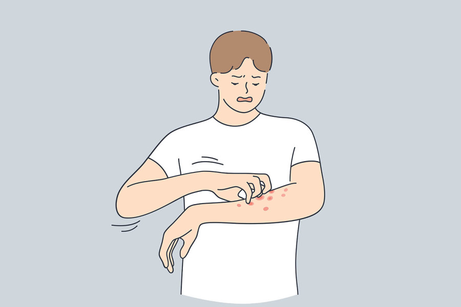 A guide to managing keratosis pilaris