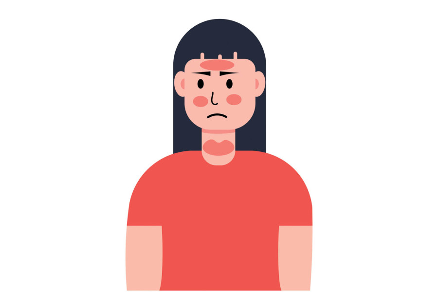 A closer look at Urticaria