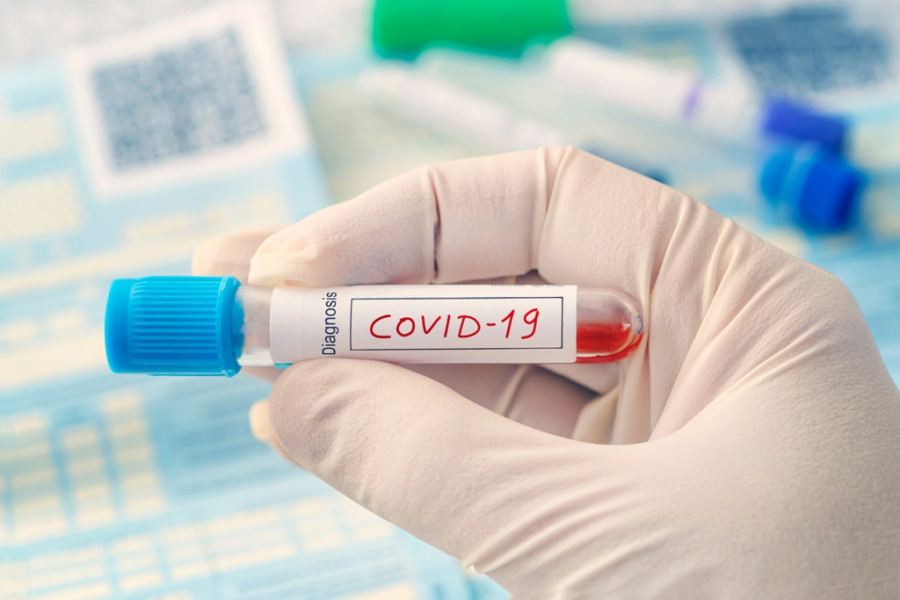 Nepal confirms spread of four new Covid subvariants—KP.1, KP.2, KP.3, KP.4