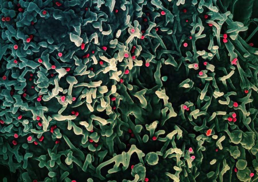 Mpox is not the new Covid, says WHO official