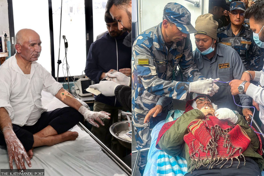 Finance minister and Pokhara mayor sustain burn injuries, admitted to ICU