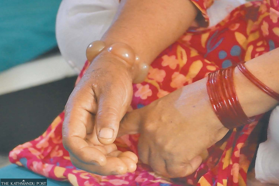 Snakebites get fatal without proper first aid as rural Nepalis lack awareness