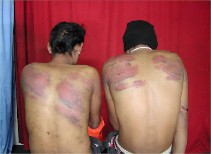 Nepal’s transgender sex workers face violence and exploitation in legal vacuum