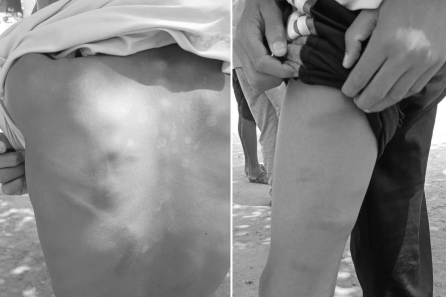 Teacher detained after allegedly beating student