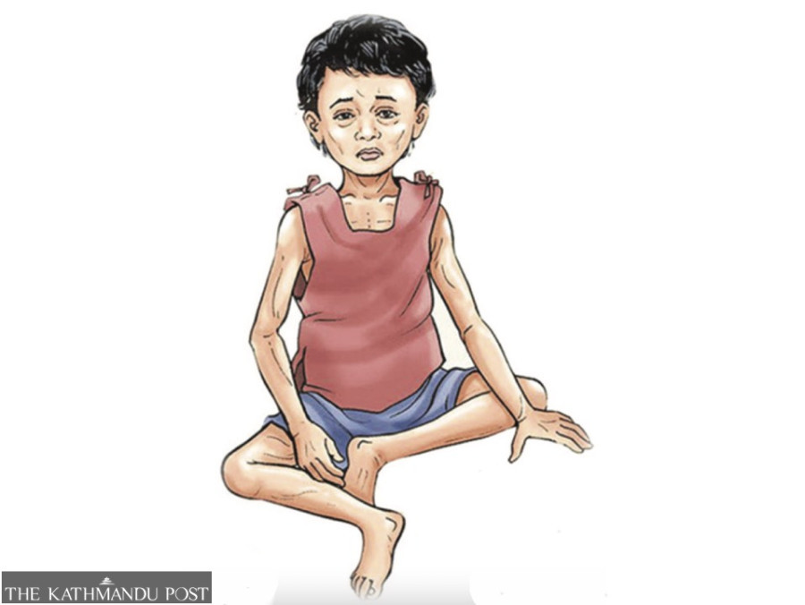Nutrition rehab expansion stalled. Children suffer